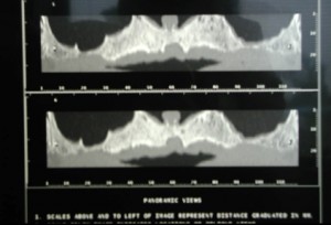 Tac Dental Scan