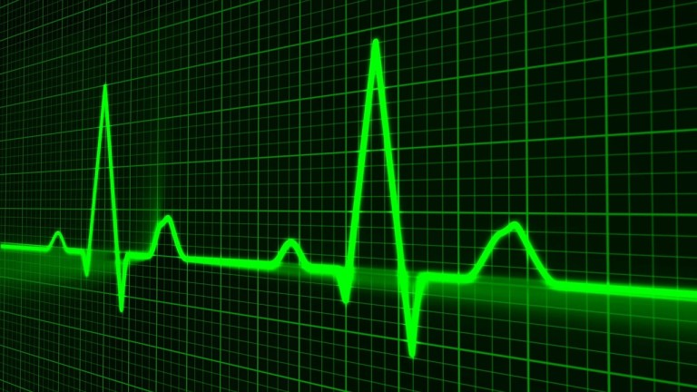 NUOVE TERAPIE ANTICOAGULANTI ORALI DR. DI PASQUALE DIRETTORE UNITA’ OPERATIVA DI CARDIOLOGIA DELL’ OSPEDALE MAGGIORE BOLOGNA da Pharma Star TV