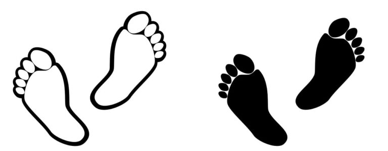IL NEUROMA DI MORTON
